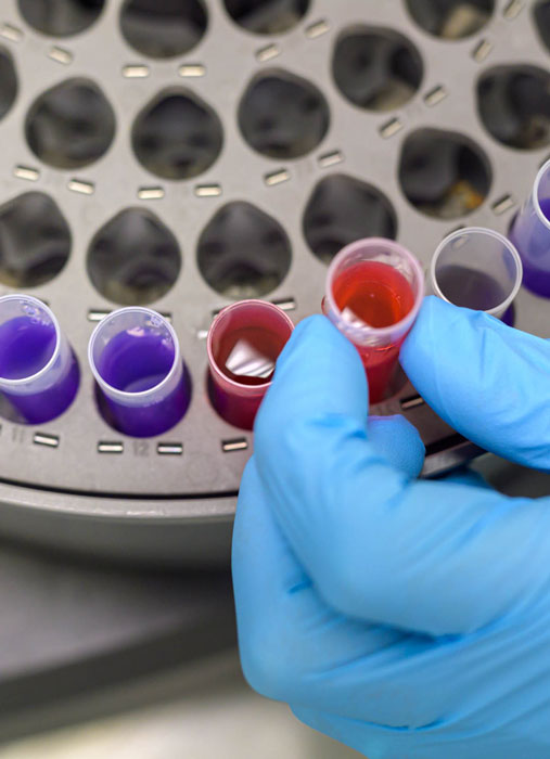 sclavo-diagnostic-erythrocyte-sedimentation-rate